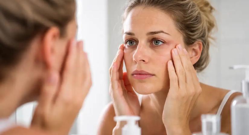 Így jelzi a bőrünk, ha túl sok sót fogyasztunk