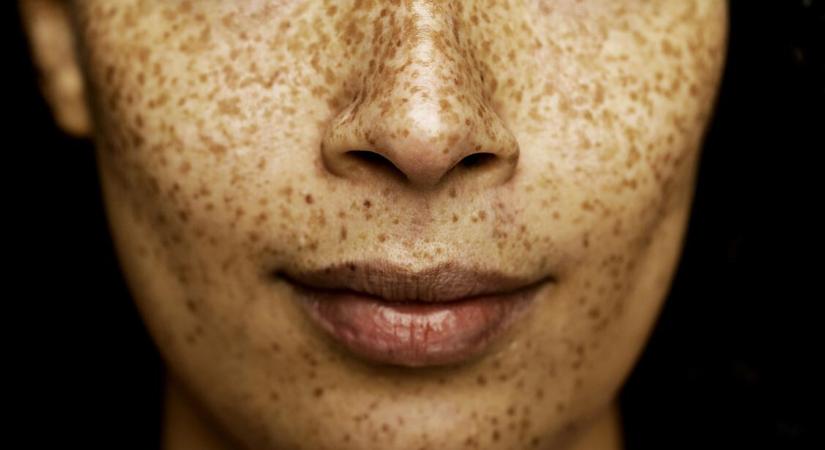 Haszontalan ez a szerv az orrban: miért van ott? – Íme a magyarázat