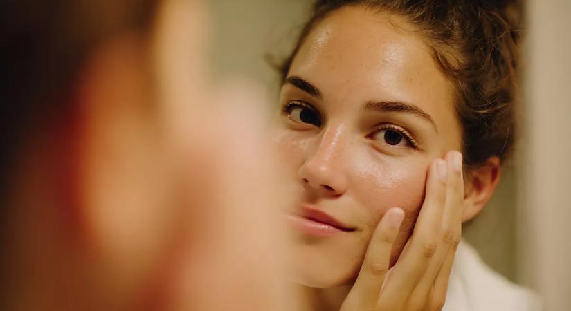 Az arcod elárul: 3 jel, hogy túl sok alkoholt vagy cukrot fogyasztasz