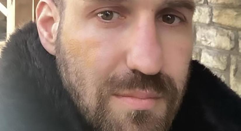 Ököllel támadtak Budapesten a Fidelitas alelnökére