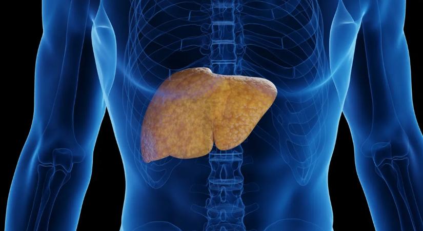 A legtöbb szülő nem tudja: ettől nőhet a zsírmáj kialakulásának kockázata a gyermekeknél