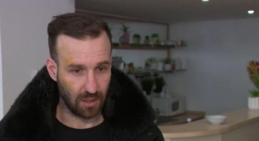 Ököllel ütötték, a földön rugdosták – így élte meg mindezt a megtámadott aktivista