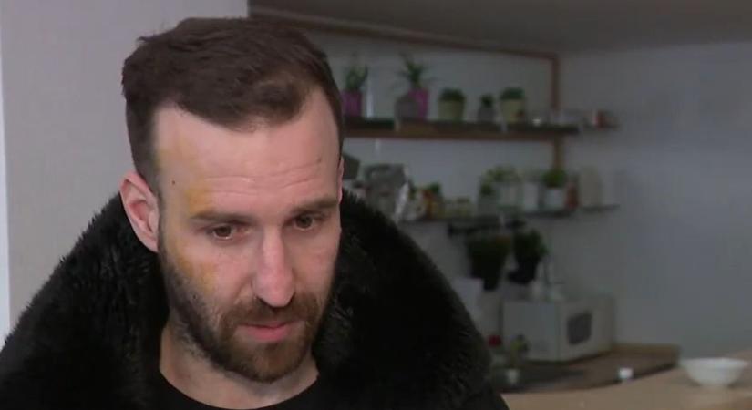Felvette a rongálót – brutális verés lett a vége egy Fidesz-aktivista számára