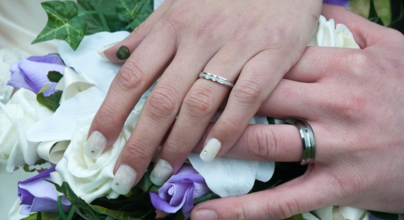 Jegygyűrűk, retinaékszerek – az örök szerelem szimbólumai