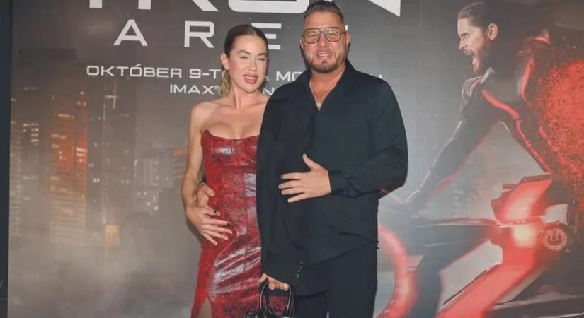 Levették a gipszet: újabb mérföldkőhöz érkezett Takács Zsuzska felépülése