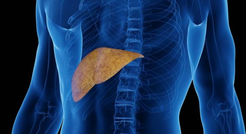 A legrosszabb ételek a májnak: ezekből nem energia, hanem azonnal zsír lesz