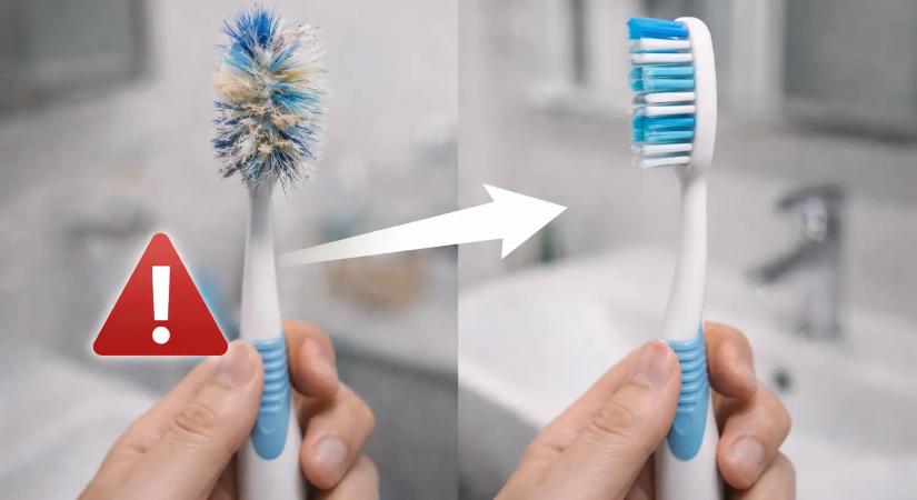 Ilyen gyakran kell lecserélni a fogkefét! Aki elfelejti, az akár az egészségét is kockáztatja