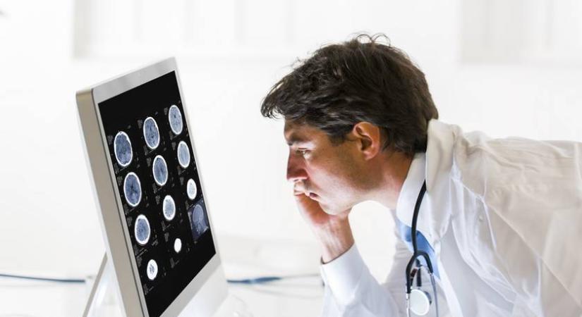 Ezeket tedd meg már fiatalon agyad egészségéért