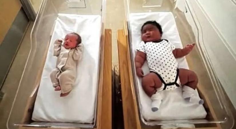 Óriásbébi született – közel kétszer nagyobb, mint egy átlagos újszülött