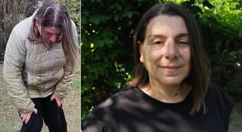 Romlik a súlyos beteg Mónika állapota, jobb lábát már nem érzi