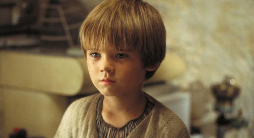 A Star Wars ifjú Anakinjának élete tragikus: így néz ki most a skizofréniával diagnosztizált sztár