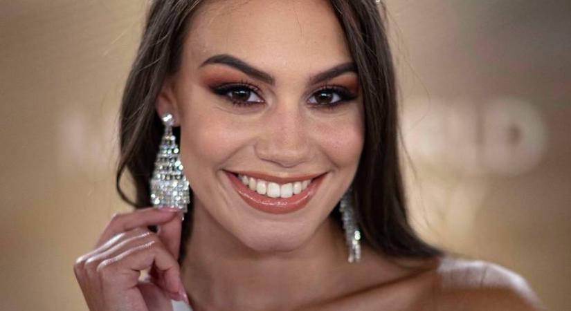 Az ATV gyönyörű műsorvezetője súlyos balesetet szenvedett: a tévében sérült meg