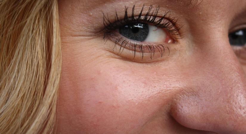 Kiderült az igazság a kollagénről: a szakértők szerint nem csodaszer, mégis meglepő hatása lehet!