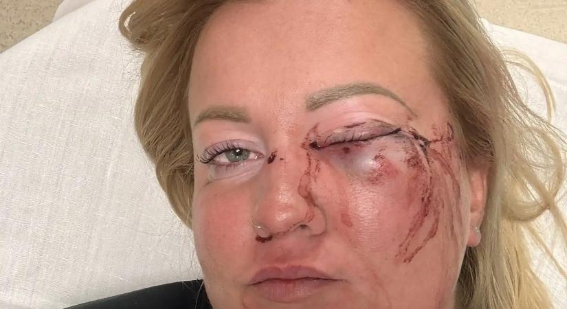 Nőt bántalmazott a szentmártonkátai alpolgármester a kolbászfesztiválon