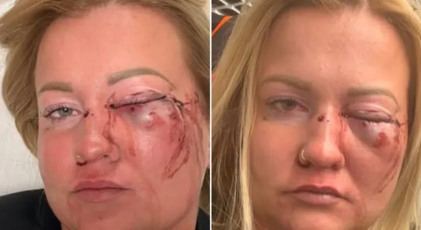 Lemondott a szentmártonkátai alpolgármester, akit azzal vádolnak, hogy súlyosan bántalmazott egy nőt