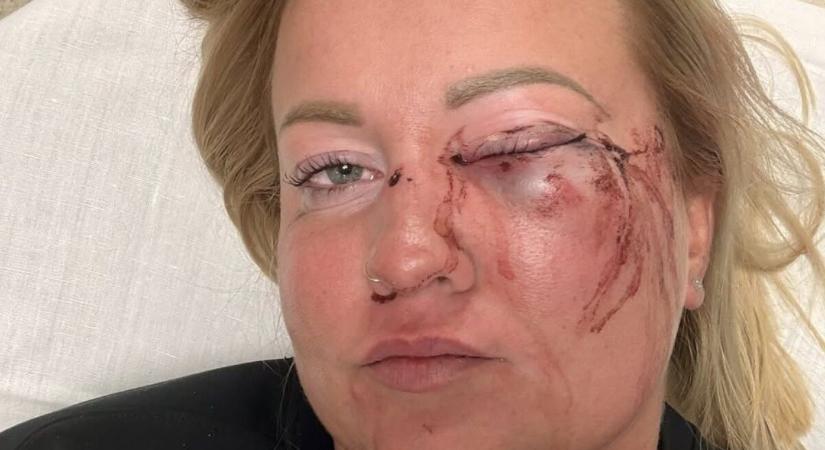 Lemondott Szentmártonkáta alpolgármestere, miután összeverhetett egy nőt