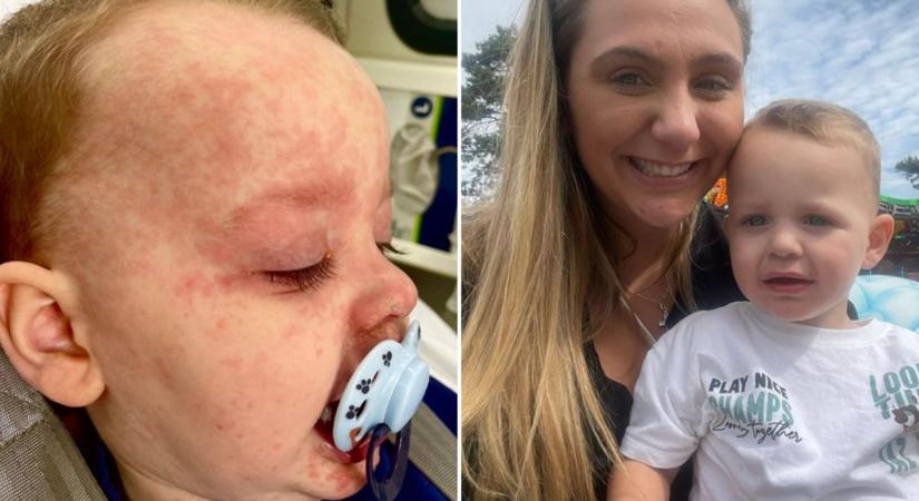 5 napig küzdött az életéért, kanyarós lett a 3 éves fiú