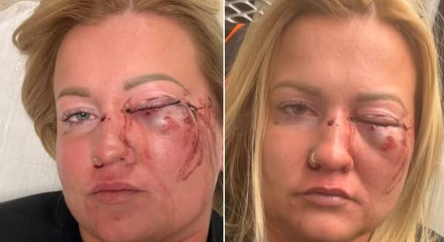 Nőveréssel vádolnak egy alpolgármestert – tagad, de lemondott, majd a Fidesz is megszólalt