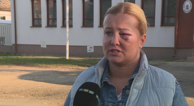 „Úgy megvert, hogy majdnem megvakultam” – lemondott a szentmártonkátai alpolgármester