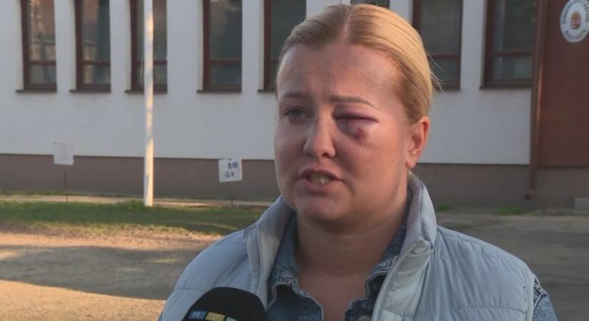 Politikai nézetkülönbség miatt fajulhatott el a vita – állítja a nő, akit összevert a szentmártonkátai alpolgármester