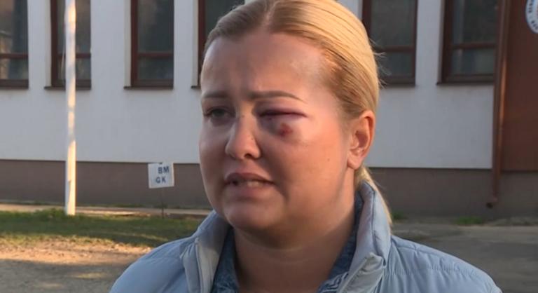 Megszólalt a nő, akit állítása szerint megvert Szentmártonkáta alpolgármestere
