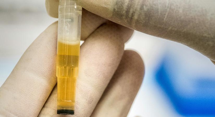 Vizeletből áram: új módszerrel termelnek tiszta energiát mikrobiális üzemanyagcellák