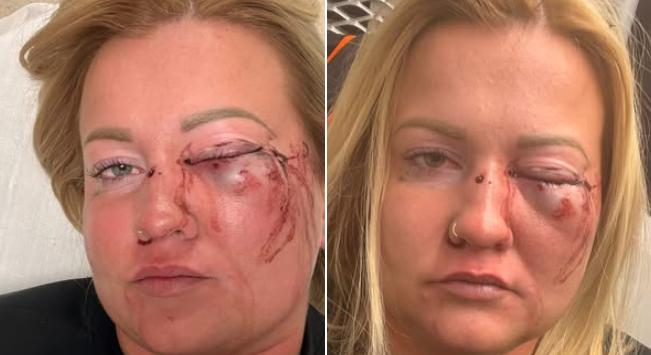 Olyan részeg volt a súlyos testi sértéssel vádolt szentmártonkátai alpolgármester, hogy csak másnap lehetett kihallgatni