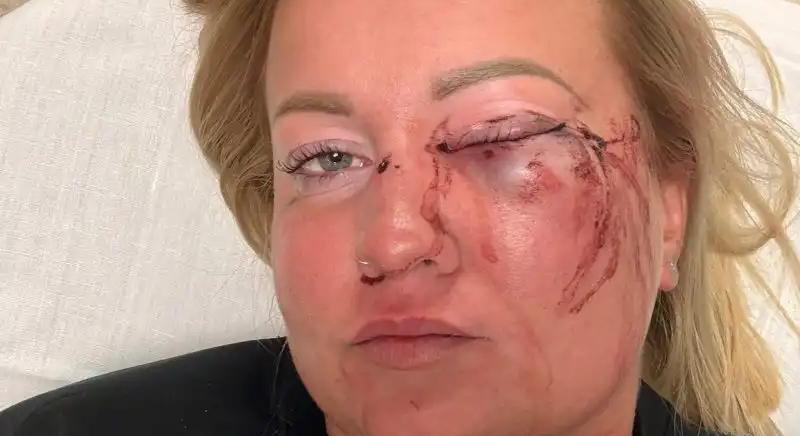 Szentmártonkátai verekedés: annyira részeg volt az alpolgármester, hogy csak másnap lehetett kihallgatni