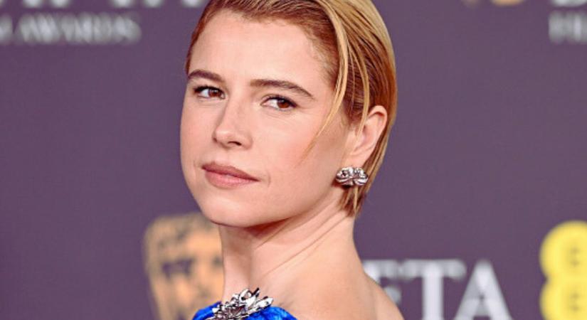 A valódi arc visszatér: miért fordulnak el a sztárok a botoxtól?