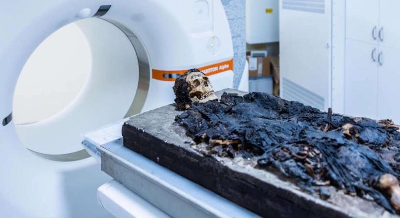 Budapesten talált római múmián végeztek CT-vizsgálatot