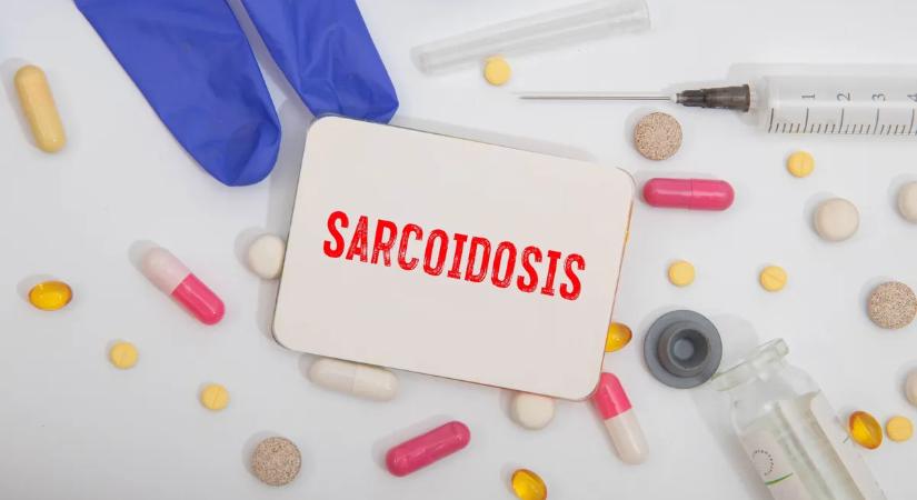 Mi az a szarkoidózis? – A ködös tüdő titka