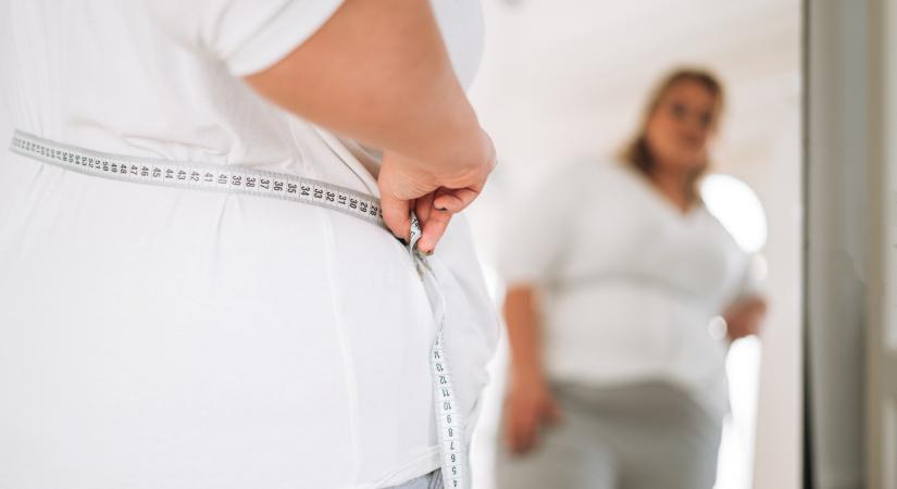 „Mintha egy 30 kilós hátizsákot cipelnénk életünk minden pillanatában” – Mit jelent az elhízás orvosi szemmel?