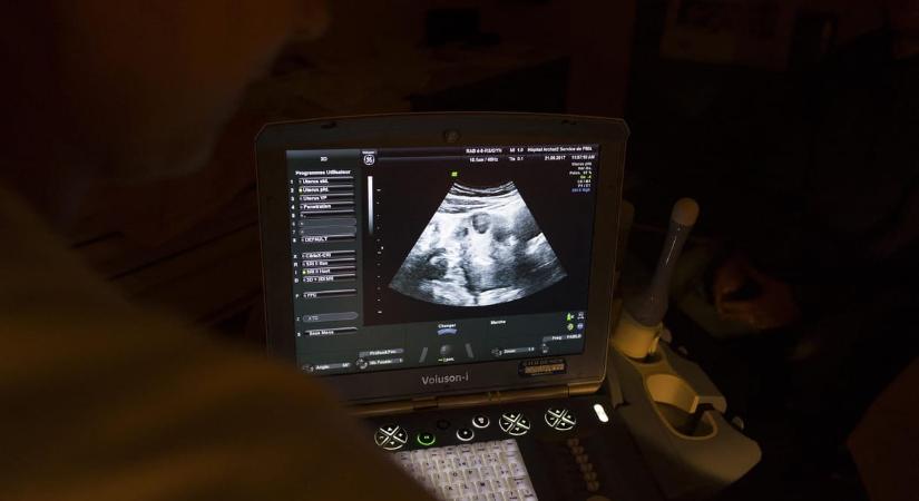 Kipróbálták magzatoknál az őssejtterápiát, ami ezután történt, az rengeteg ember életét megváltoztathatja