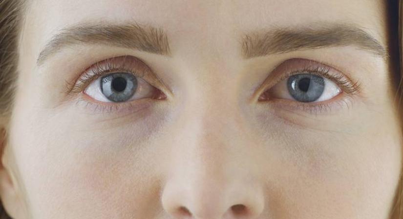 Az egyik legfontosabb ásványi anyag hiányzik, ha ilyen az arcod: durván megváltozik a szerkezete