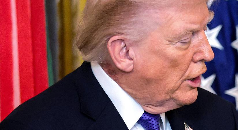 Miközben Trump Iránnal háborúzik, mindenki a nyakára figyel