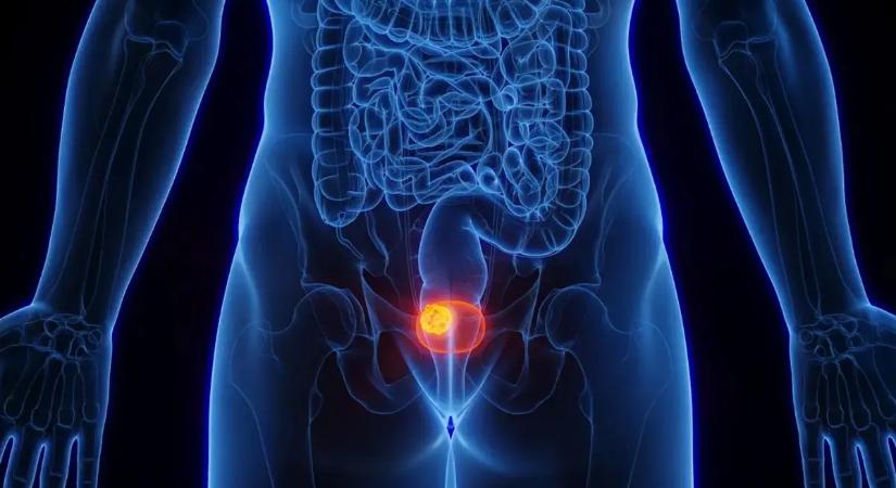 Sokkoló adat: tömegesen diagnosztizálják félre a nőket ezzel a betegséggel