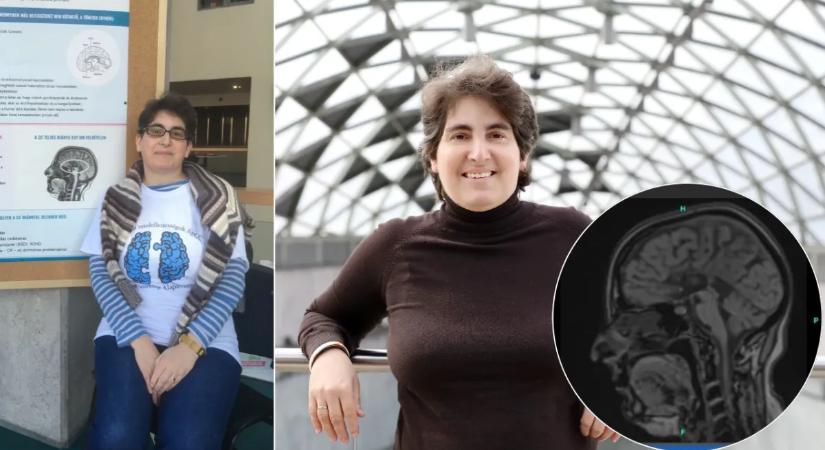 „Elképesztő nehézségekkel kellett szembenéznem”–Lyukas aggyal él Eszter