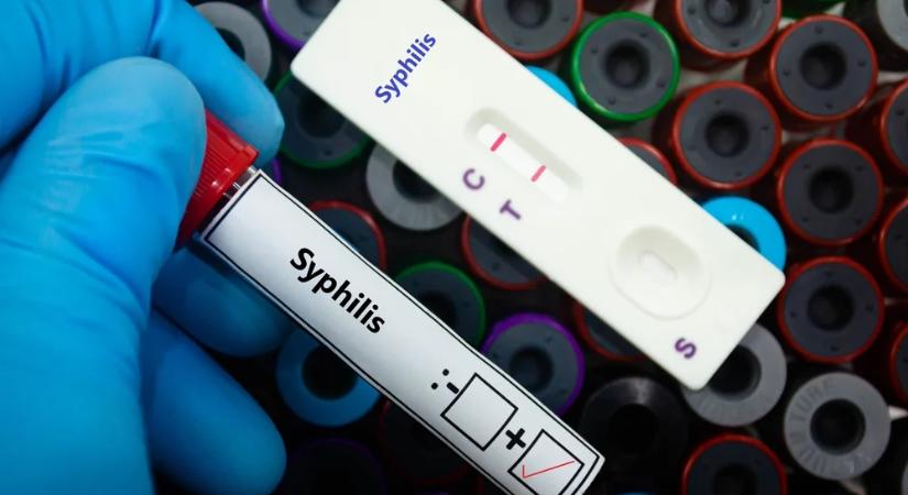 Csecsemők halnak meg egy kezelhető fertőzés miatt Magyarországon