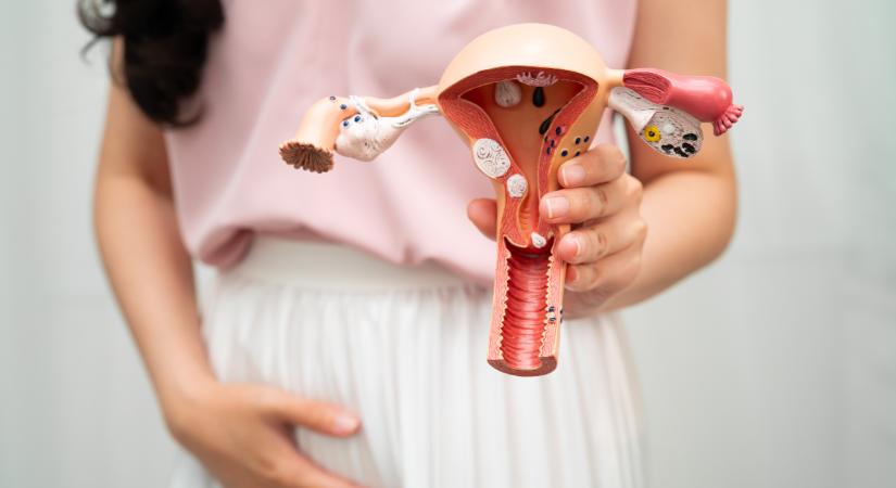 Mi az a petefészek ciszta, és mennyire gyakori?