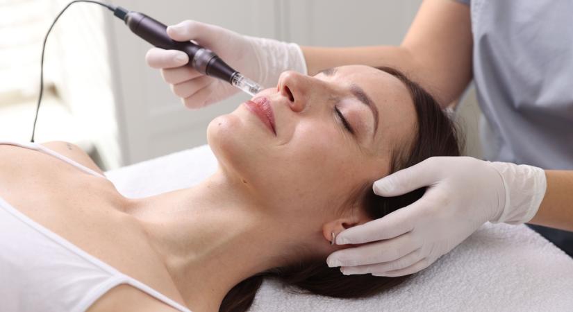 Lazacsperma az arcodra? Az új anti-aging trendtől mindenki ledöbbent