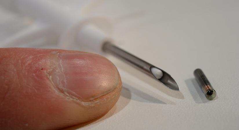 Nem lehet majd akaratuk ellenére chipet ültetni a dolgozókba Washingtonban