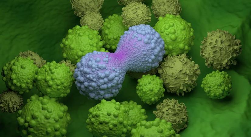 Kiderült, miért van egyre több mellrákos – 7 okot jelöltek meg a szakértők