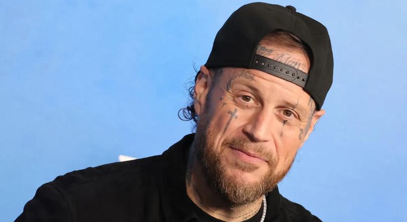 Jelly Roll kórházba került, súlyos balesetet szenvedett