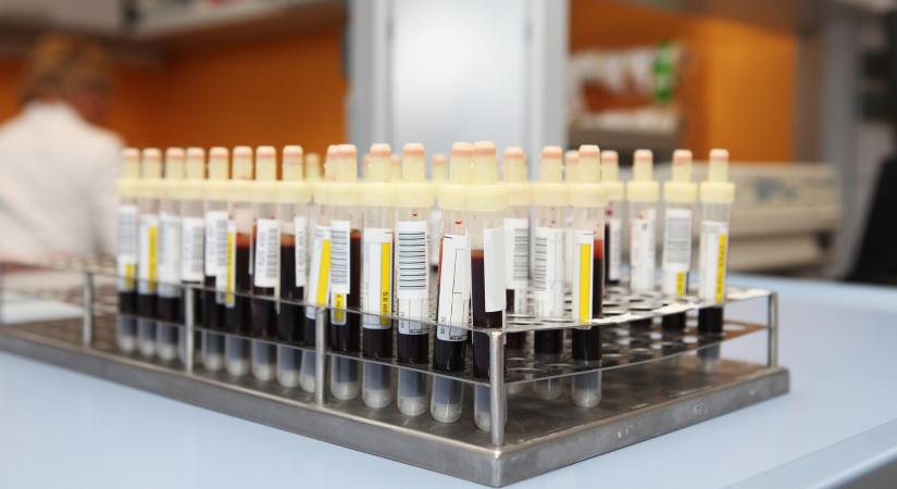 Ennél a vércsoportnál magasabb lehet a stroke veszélye – főleg 60 év alatt
