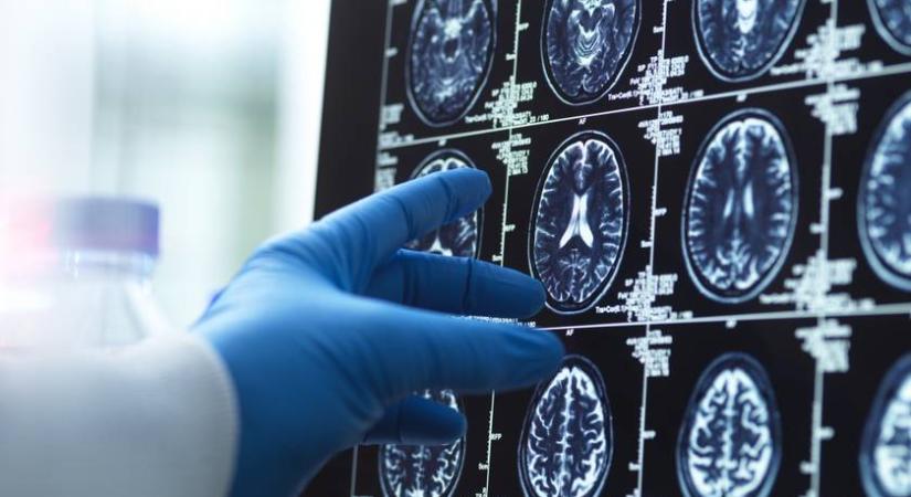 Megtalálhatták a rettegett betegség leghatékonyabb ellenszereit, ezek a gyógyszerek is a listán vannak