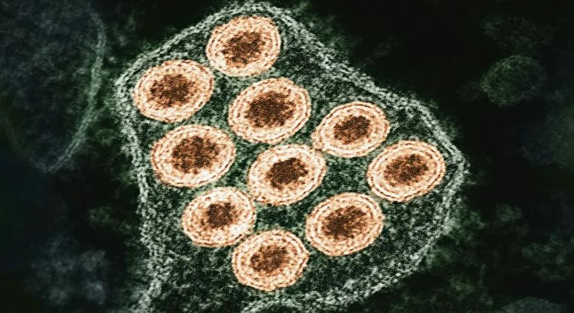 Ritka fertőzés végzett a nagymamával – mire felismerték a tüneteket, már késő volt