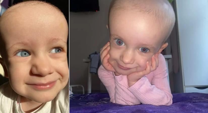 Segített a Bors: félmillió forint gyűlt össze az agydaganaros Hanna kezelésére