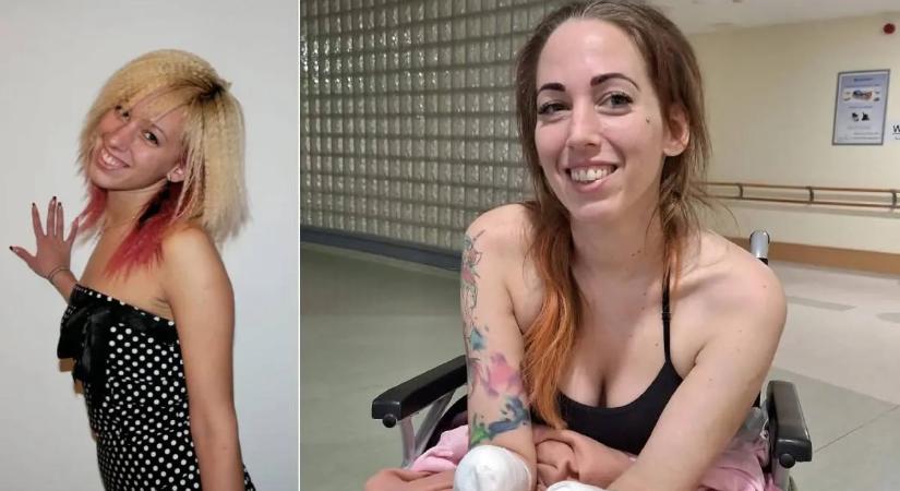 Elkezdődött a rehabilitáció: Fogat mos, villával eszik és már ollóval is vág a négy végtagját elvesztett Fanni