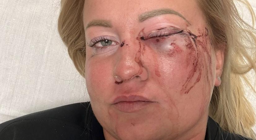 Szentmártonkáta polgármestere a megvert asszonyról: eléggé teltkarcsú, nem hinném, hogy ajánlatot tettek neki