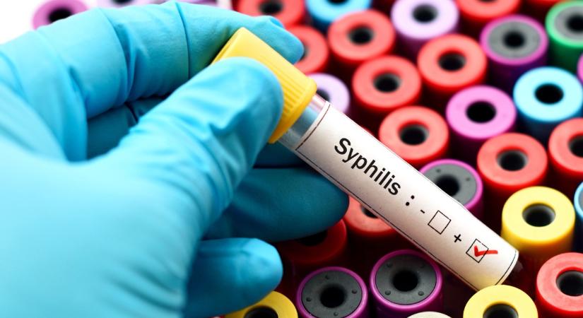 Egyre több a szifiliszes újszülött, országos szűrőprogramot indít az NNGYK
